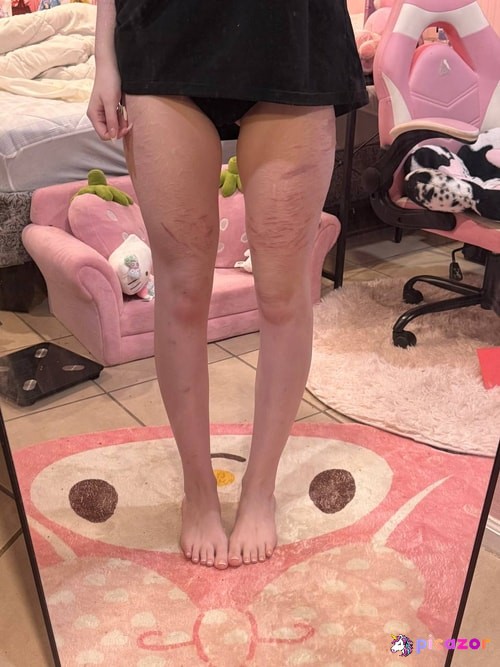 sickndcute  - Image