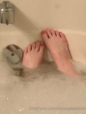 myskyewatson N72