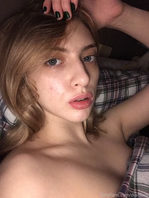 Dionkadi czkrok N21