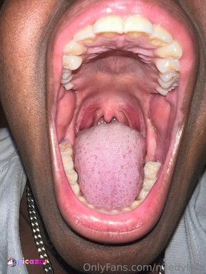 n3edymouth N3