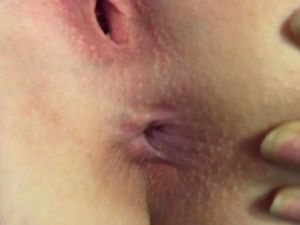 Lovelydane  - Thumb