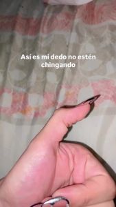 Aby Dazai N3