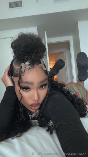 double-dose-twins photo #31 photo n 31