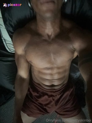 prettyskinboi photo #26 photo n 26