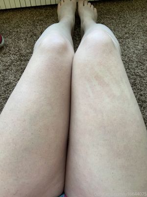 freckledspirit-1 photo #80 photo n 80