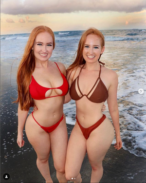 burinski-twins photo #2 photo n 2