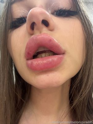 melonipinkbb - Thumb